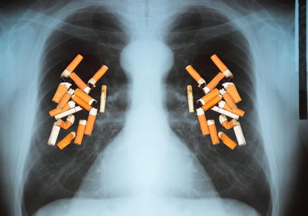 Kā cigaretes ietekmē plaušas